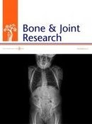 Bone & Joint Research Article Cover